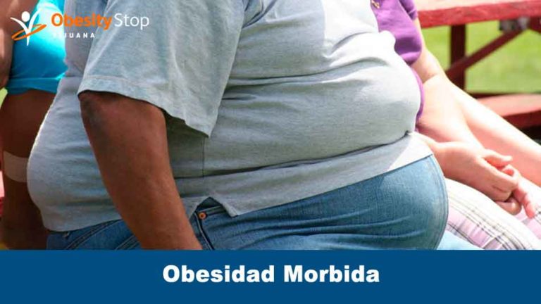 Obesidad Mórbida ¿qué Es La Obesidad Mórbida Y Su Solución